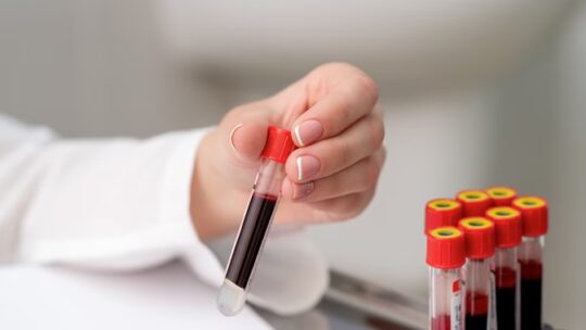 здача аналізів