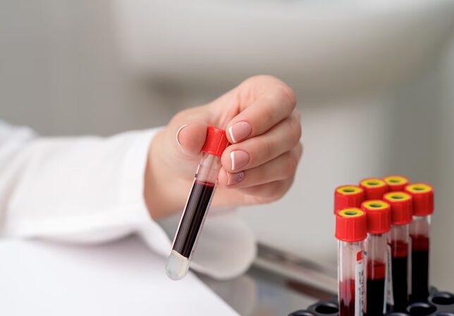 здача аналізів